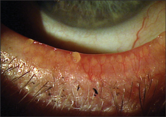 Optometric Management | PentaVision